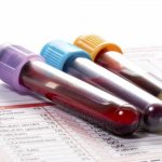 Blood test for electrolytes: description, testing, norm and deviations, features