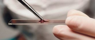 Анализ крови на лямблии аскариды гельминты