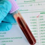 Анализ крови в пробирке