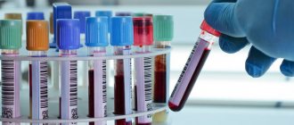 Антитела IgM (иммуноглобулин М) в диагностике инфекций: значение, показания, расшифровка результатов