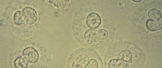 protein and leukocytes in urine