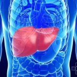 Liver disease may cause low PLT levels