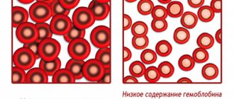 Что такое MCHC в анализе крови