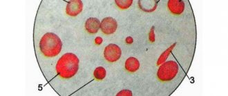 Degeneratively changed and normal red blood cells