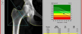 Densitometry - what is this procedure?