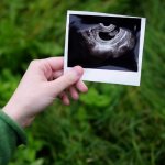 Holding an ultrasound scan of the fetus