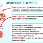 Red blood cells in urine tests