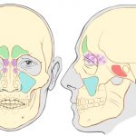 Maxillary sinuses. Location, photo, anatomy, cyst, inflammation, mycetoma, pain, symptoms and treatment 