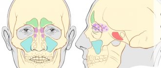 Maxillary sinuses. Location, photo, anatomy, cyst, inflammation, mycetoma, pain, symptoms and treatment 