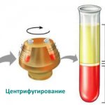 Hematocrit is low, what does this mean?