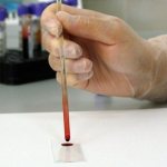 GGT in biochemical blood test