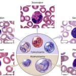 GRA in blood test. What is it, explanation, the norm for women, children, men. What does it mean to do 