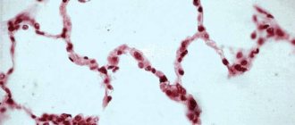 changes in squamous epithelium