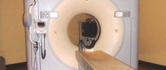 How MRI and other types of brain studies are done (9 photos)
