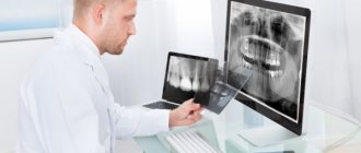 Как использует врач результаты КТ зубов