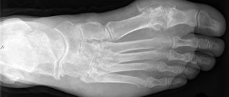 How to prepare for a foot x-ray