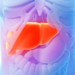 Classification of cirrhosis