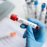 When does an HIV test give a false result?