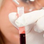 Лаборант делает анализ крови
