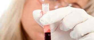 Laboratory technician doing a blood test