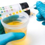 Laboratory urine analysis