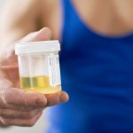 leukocytes in a man&#39;s urine are increased