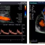 Color Doppler scanning method