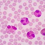 Many eosinophils