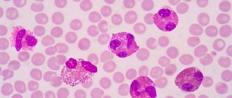 Many eosinophils