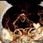 MSCT – multilayer computed tomography