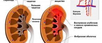 Нарушение деятельности почечных клубочков