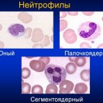 Neutrophils in the blood of women. Norm by age, during pregnancy, table 