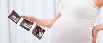 Determining the sex of a child by ultrasound