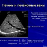 Liver and hepatic veins on ultrasound