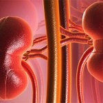 renal failure