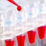 подготовка к сдачи крови на биохимический анализ