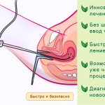 Advantages of the procedure - Hysteroscopy for IVF