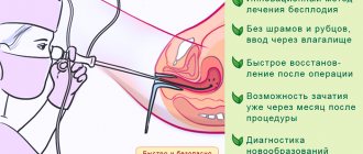 Advantages of the procedure - Hysteroscopy for IVF