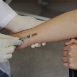 Mantoux test