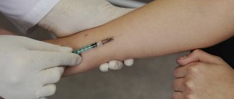 Mantoux test