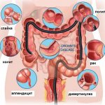 check your intestines without a colonoscopy