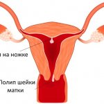 The size of the uterus is normal in women according to ultrasound. Table by age, nulliparous, during pregnancy, after childbirth, during menopause 