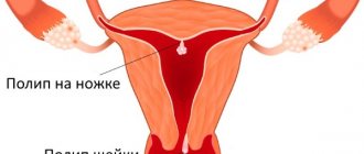 The size of the uterus is normal in women according to ultrasound. Table by age, nulliparous, during pregnancy, after childbirth, during menopause 