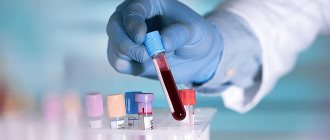 Сдача анализа крови на ХГЧ