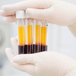 donating blood plasma: benefits and harms