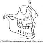 Схема проекции верхушек корней зубов на кожу лица
