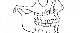 Scheme of the projection of the apexes of the roots of the teeth onto the skin of the face