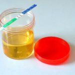 How long can urine be stored for pregnancy testing?