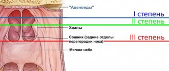 Degrees of inflammation of the adenoids