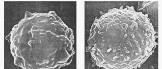 Т-лимфоцит и В-лимфоцит под микроскопом